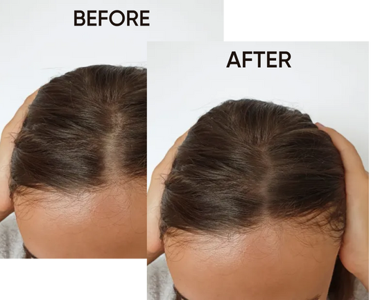 Care Hair Growth™ - AMIRCAL
